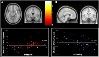 Mediating effect of amygdala activity on response to fear vs. happiness in youth with significant levels of irritability and disruptive mood and behavior disorders